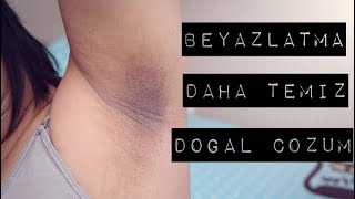 bu kararma nasil gecer cozumu olmaz diyenler icin tugce ay youtube bu kararma nasil gecer cozumu olmaz diyenler icin tugce ay youtube