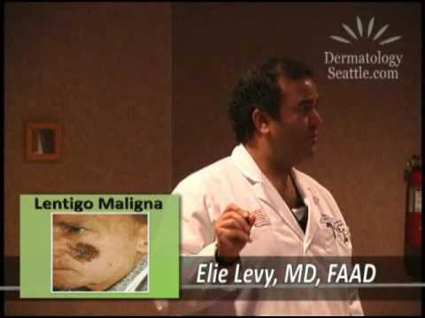 Dermatology Of Seattle Presents: Your Guide To Skin Cancers