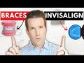 Braces vs. Invisalign | How to choose between the two?!