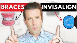 Braces vs. Invisalign | How to choose between the two?!
