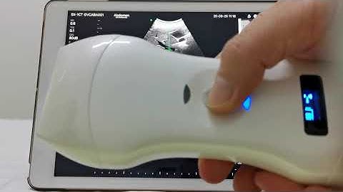 Double Probes Wireless Handheld Ultrasound Scanner-D5CL