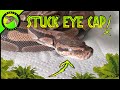 How to Take a Stuck Eye Cap Off a Snake! (Ball Python)