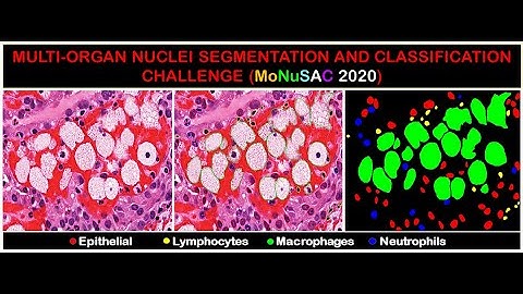 ISBI 2020 MoNuSAC Workshop
