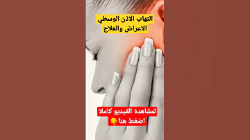 التهاب الاذن الوسطي الاسباب والعلاج 