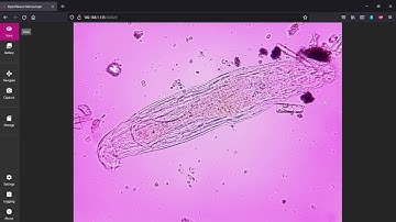 OpenFlexure Microscope — 40X objective