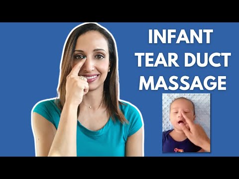 Tear Duct Massage (Crigler) For Infants #Crigler #nldo #tearductobstruction