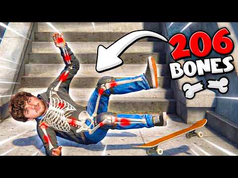 Breaking ALL BONES As a PRO SKATEBOARDER!