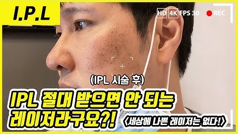 IPL은 절대 받으면 안 되는 레이저라구요?! (Feat. 세상에 나쁜 레이저는 없다)