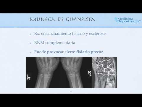 Vídeo: LESIÓ DE LA INFÀNCIA