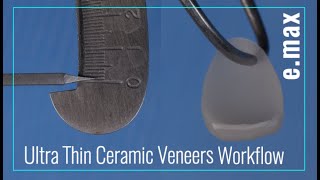 Finishing Thin Prepless Ceramic Veneers