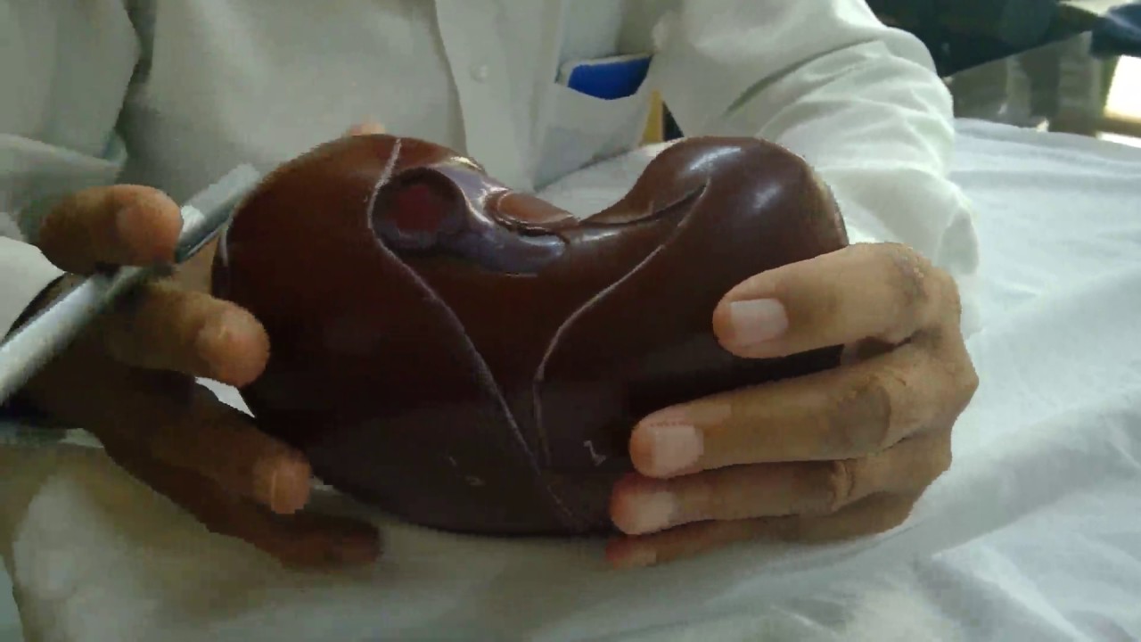 Liver Anatomy Part 1 - YouTube