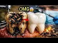 Daant saaf karne ka tarika|teeth whitening at home|white teeth 🦷