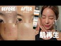 🇰🇷リジュランを越える(?)ヤバい肌再生クリーム見つけた!☆ #파데프리 #リジュラン #肌再生 #ノーファンデ #ノーファンデ生活