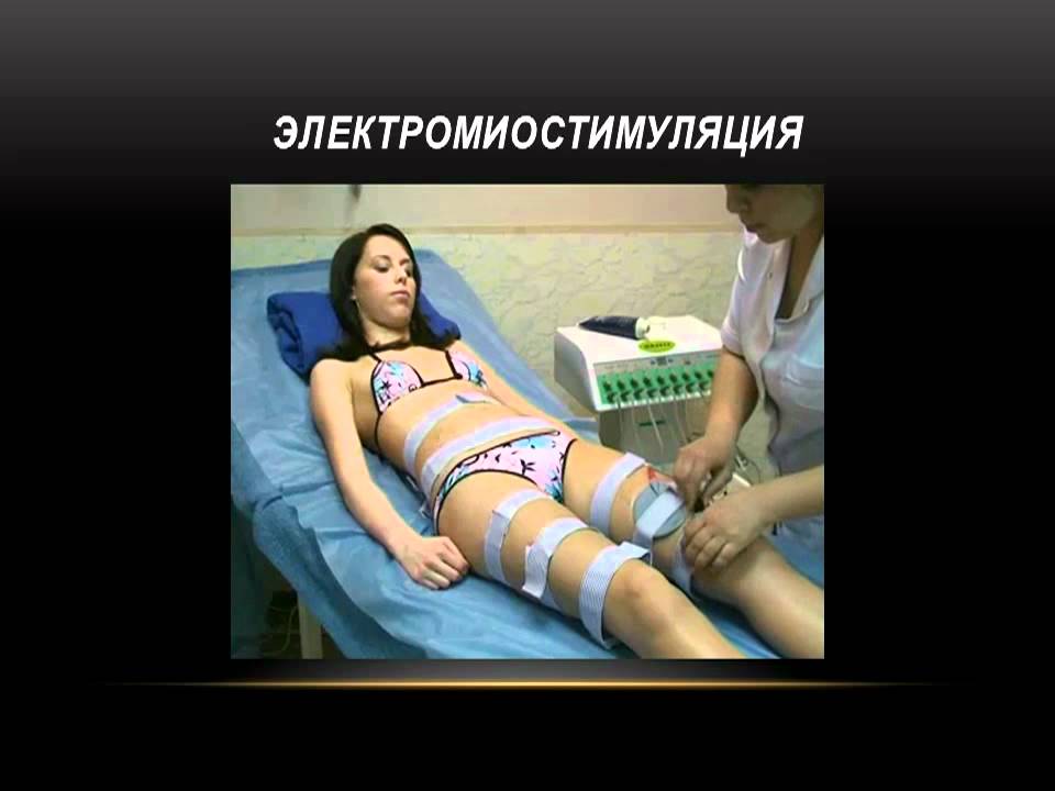 Миостимуляция.flv