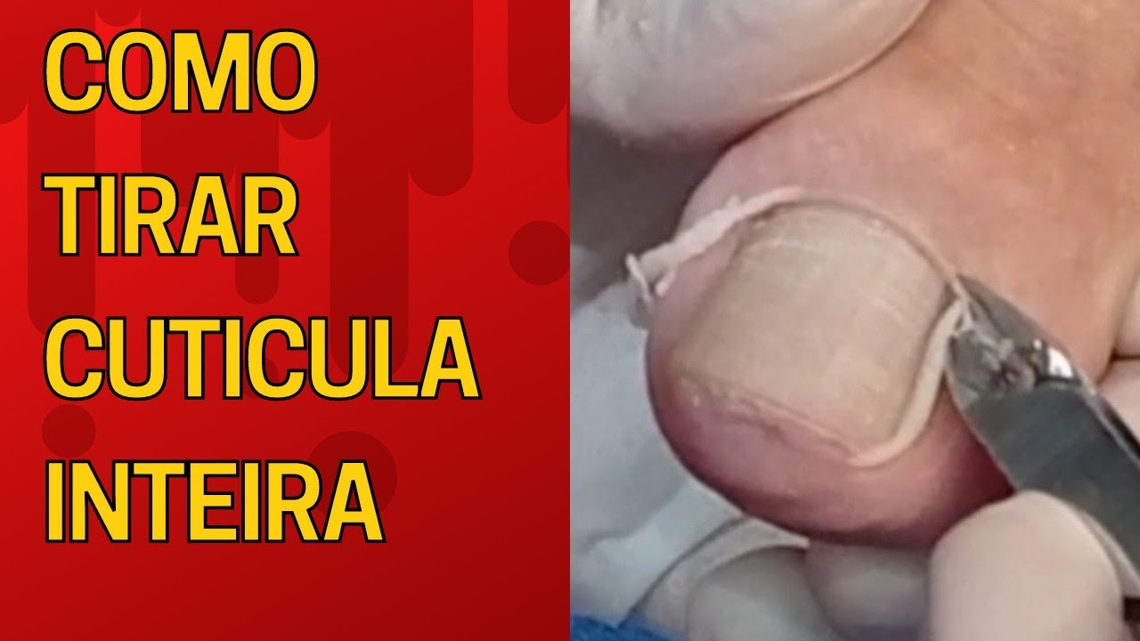 Veja como tirar Cuticula inteira e funda sem tirar bife? Passo a  passos  simples que vai te ajudar!