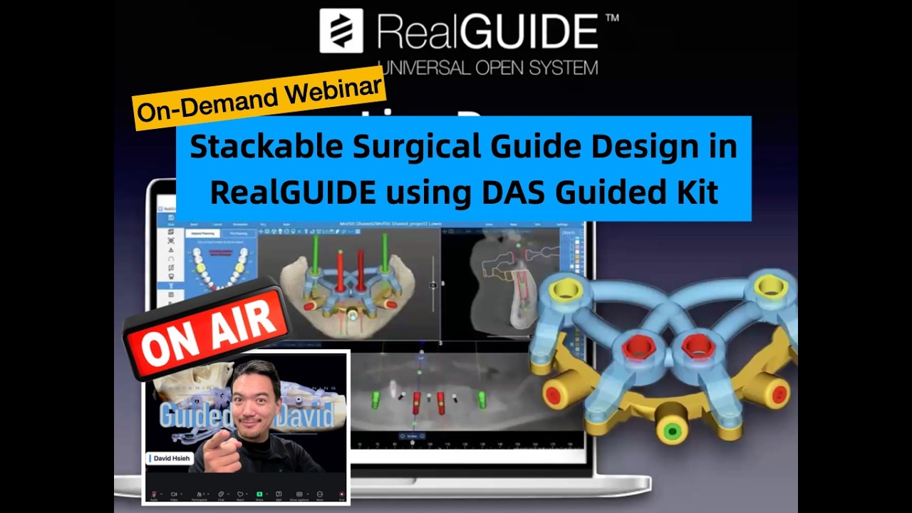Stackable Guide Design in RealGUIDE using DAS guided kit. On-Demand webinar