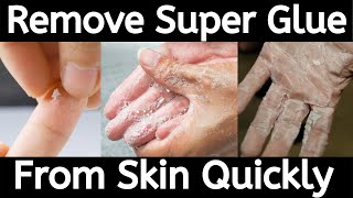 How to Get Super Glue off Your Skin
