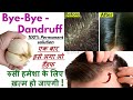 Dandruff Ka Permanent Solution At Home | In 7 Days Remove 100% Dandruff | Dandruff ka pakka ilaj