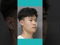 25岁小哥脸型方长，太困扰，想要协调一点。 #beautiful #face #plastic #plasticsurgery #整形 #shorts