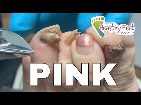 Video LONG HOT PINK NAILS CUTTING - youtube