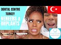 I HAD MY TEETH DONE IN TURKEY!? PART 1 |  DENTAL CENTRE TURKEY |  Hollywood Smile Makeover | Veneers