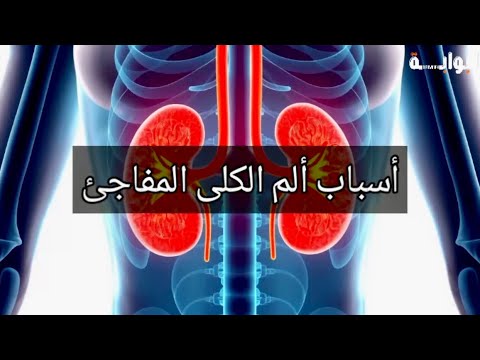 أسباب ألم الكلى المفاجئ تعرف على الأسباب الشائعة