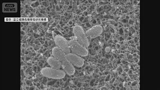 【速報】「百日せき」1週間の全国の感染者数3353人　過去最多を更新　厚労省(2025年7月8日)