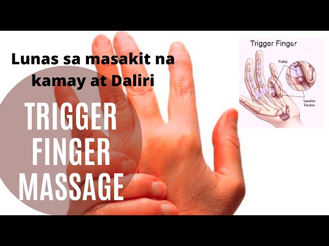 Trigger finger: Causes, treatment, and remedies