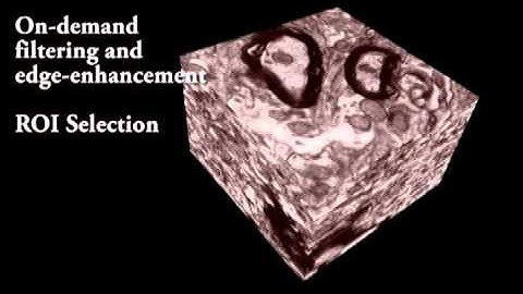 Scalable and Interactive Segmentation and Visualization of Neural Processes in EM Datasets