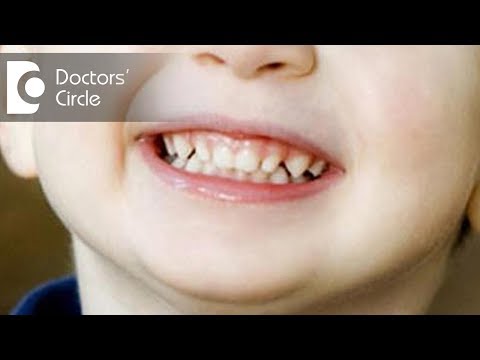 How can I help my child stop grinding his teeth? - Dr. Srivats Bharadwaj