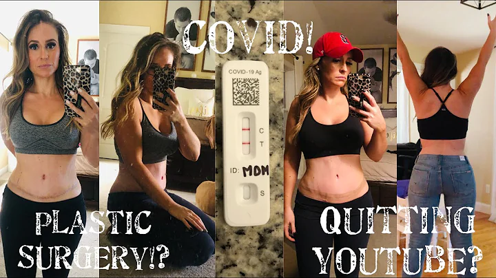 WHERE HAVE I BEEN!?|PLASTIC SURGERY!? COVID!? QUIT...