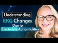 Electrolytes and EKG changes - NCLEX Questions - Archer NCLEX Review