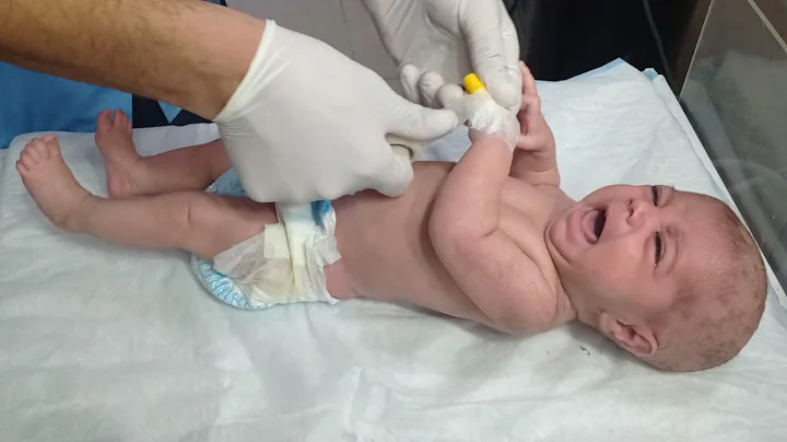 How to Pass IV Line to a Baby | Pediatric IV Cannulation Step by Step