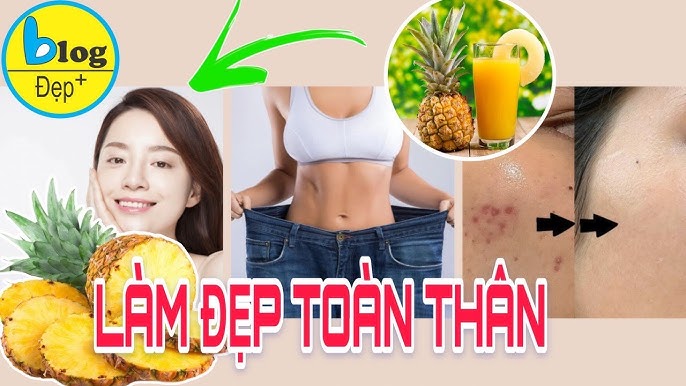 6. Xu Hướng Thời Trang Với Dép Quả Dứa