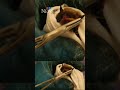 Rabid bat discovered in Regina