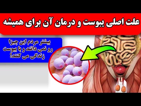 علت یبوست و راه حل قطعی برای یبوست که اکثر مردم نمیدانند!یبوست خود را سه سوته درمان کنید!