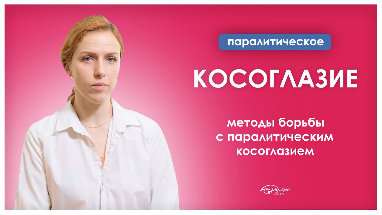 Паралитическое косоглазие