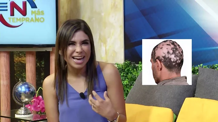 LA DERMATLOGA PEDIATRA DINORA CHAVEZ HABLA DE LA A...