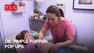 Dr. Sandra takes on Neurofibromatosis | Dr. Pimple Popper: Pop Ups