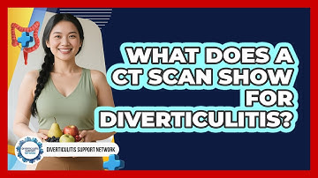 What Does A CT Scan Show For Diverticulitis? - Diverticulitis Support Network