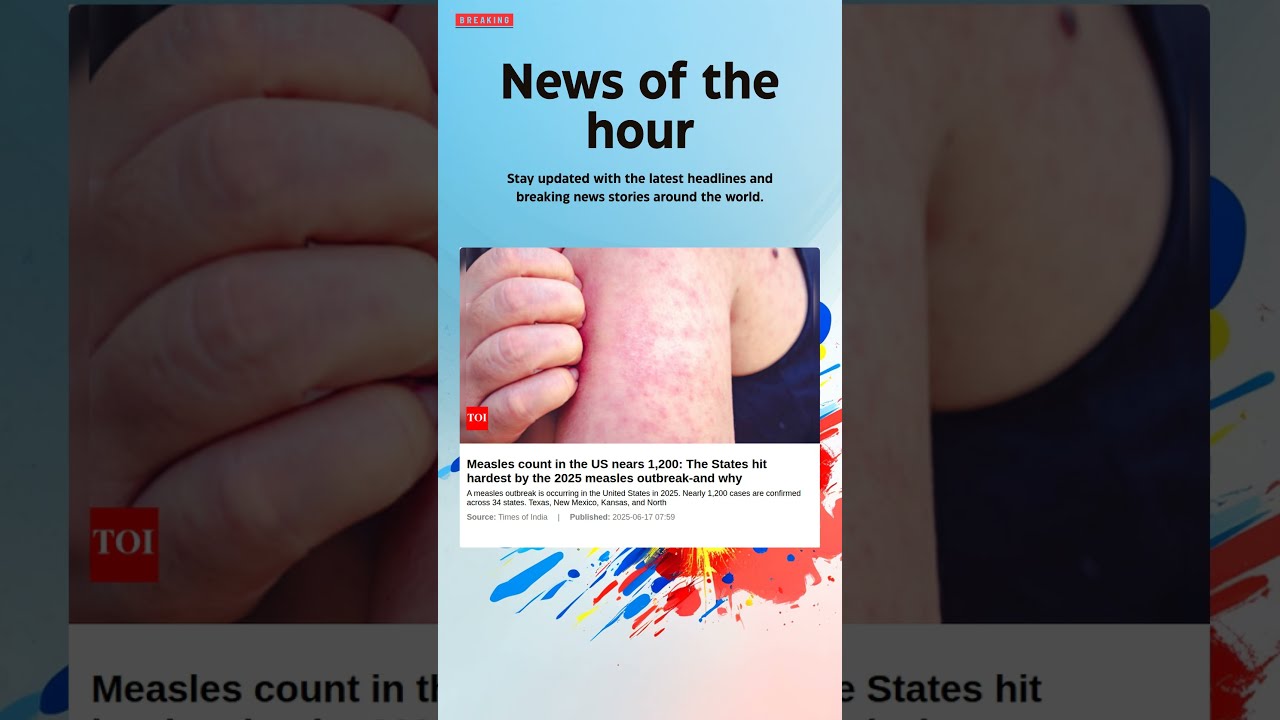 Breaking News Measles Count In The US Nears 1 200 States Hit Hardest By 2025