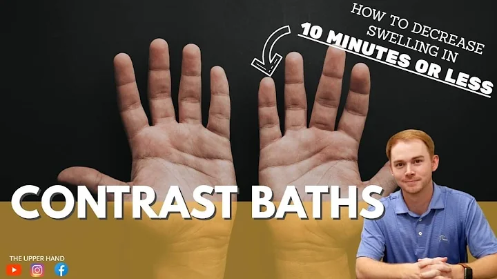 SWOLLEN HAND?? Reduce EDEMA in 10 minutes or LESS!