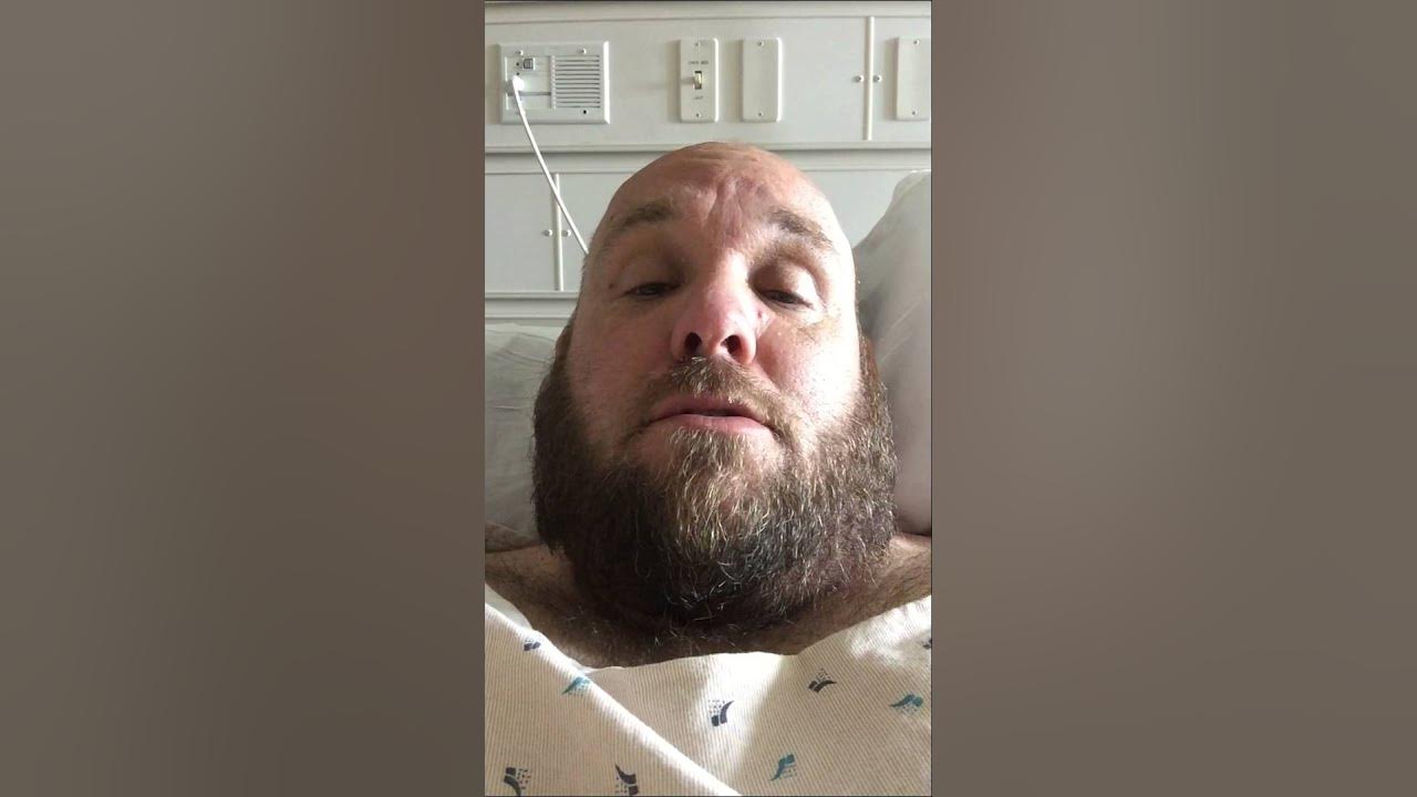 More from my Kaiser hospital bed Vertical a Gastric Sleeve VGS