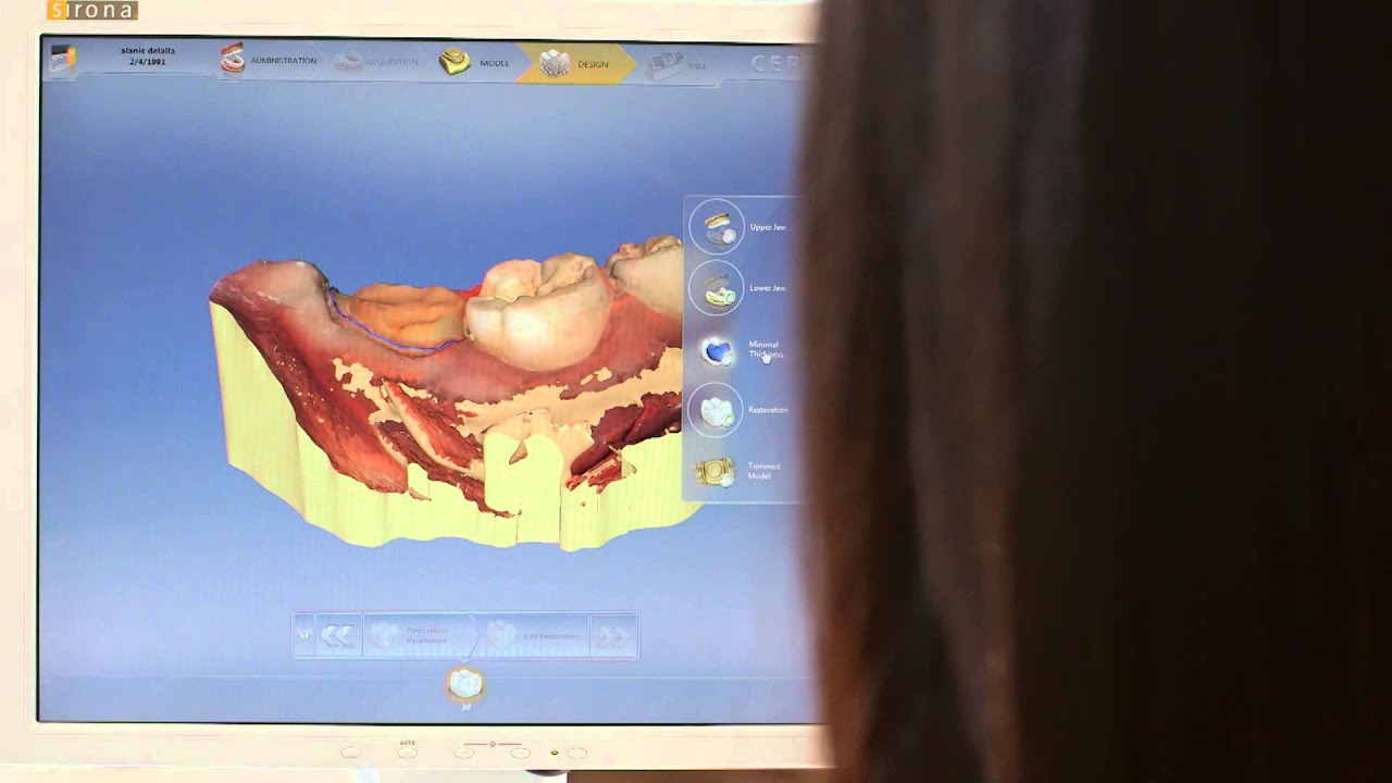 Cerec Crown Machine at ADA