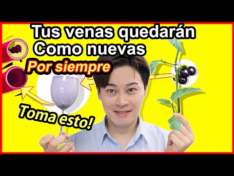 tus venas ya quedarán sanas <strong>como</strong> nuevas con <strong>ESTA</strong> PLANTA | Remedio casero