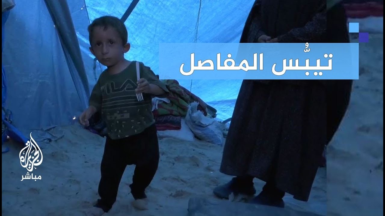 "قدم أطول من أخرى" معاناة طفل بمخيمات النزوح