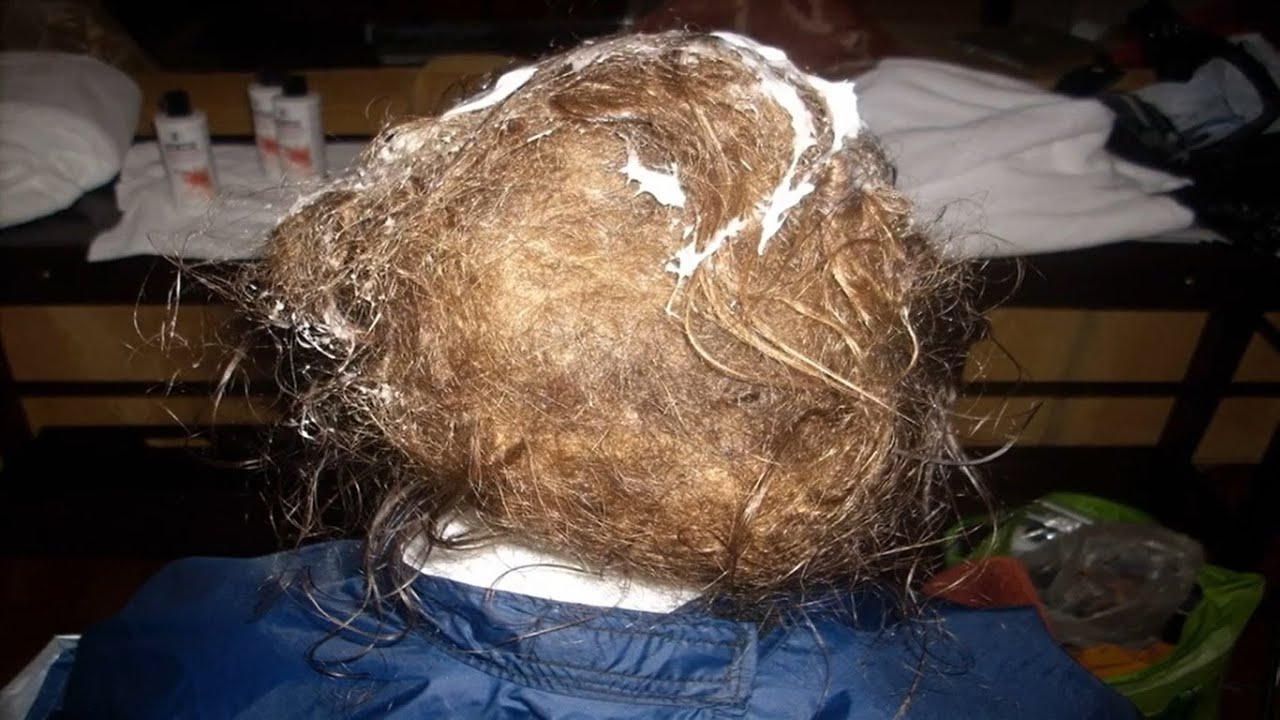 How To Get Rid Of Matted Hair Clumps - How Can I Detangle A Massive Ball Of Matted  Hair - YouTube
