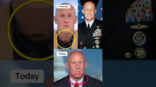 Admiral Robert Harward is back on Fox News, wearing HIGH-COLLARED SHIRT. His eye color are different