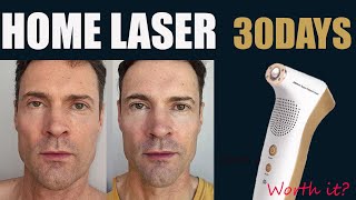 I Tried a Clinic Laser at Home and Here s What Happened