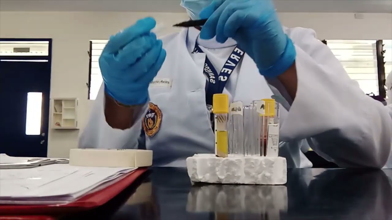 MANTIZA, MILBEE GRACE J. BSMLS 4E GROUP 2